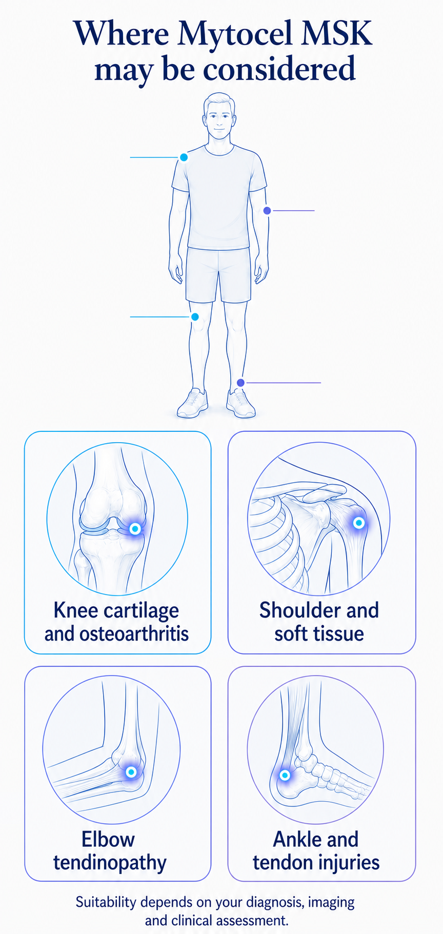 Illustrated overview of knee, shoulder, elbow and ankle areas where Mytocel MSK may be considered following clinical assessment.